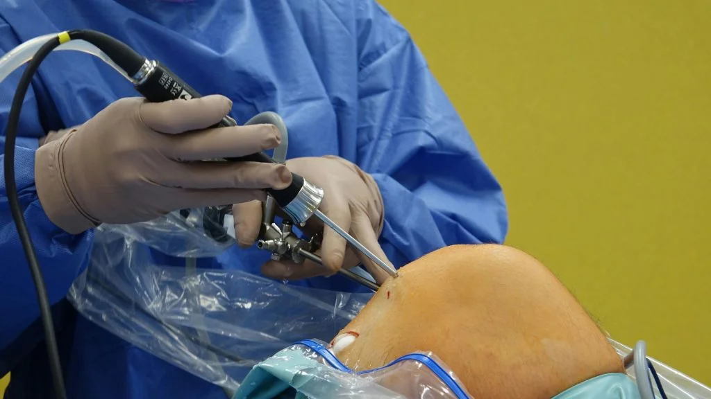 Arthroscopic ACL Surgery
