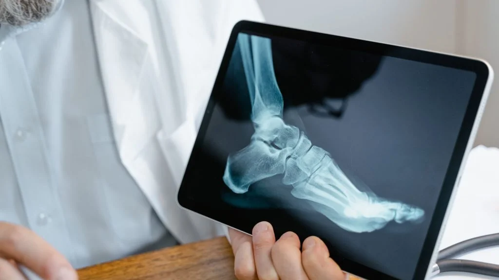 Bone Health and Nutrition