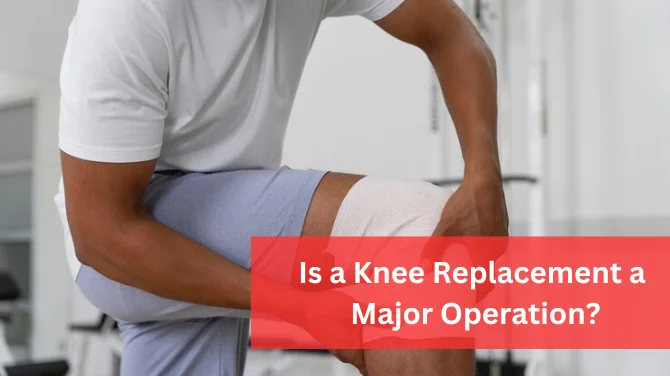 Knee Replacement Major Operation