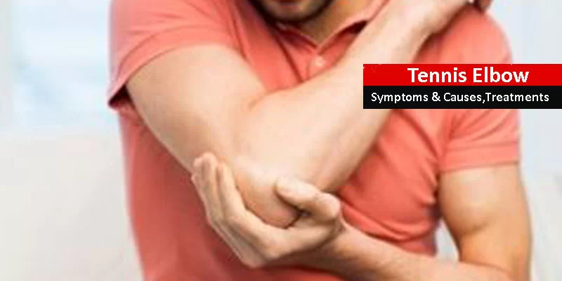 Tennis Elbow, causes, and Treatments