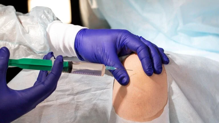 Knee Replacement Hyderabad