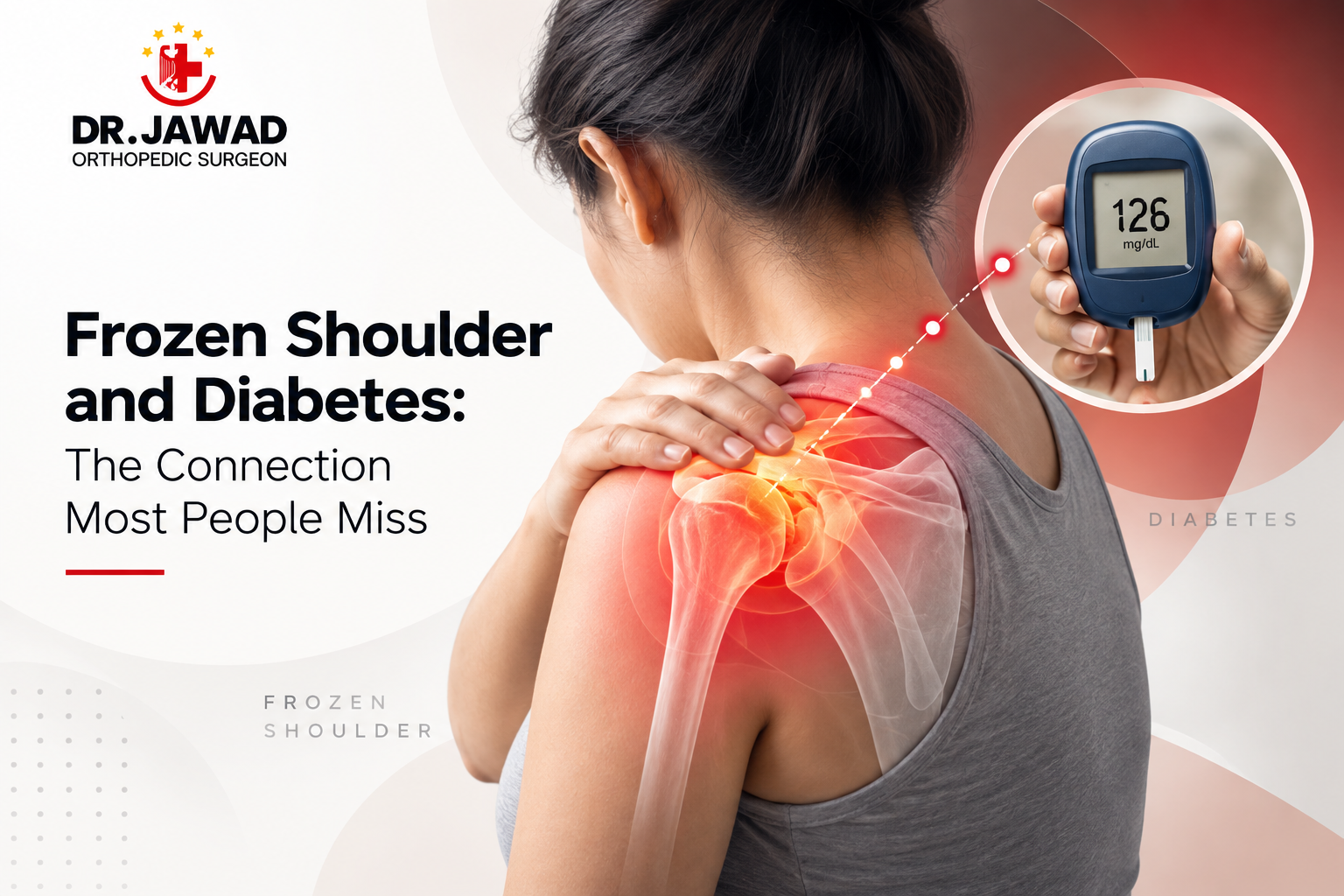 Frozen Shoulder and Diabetes: The Link