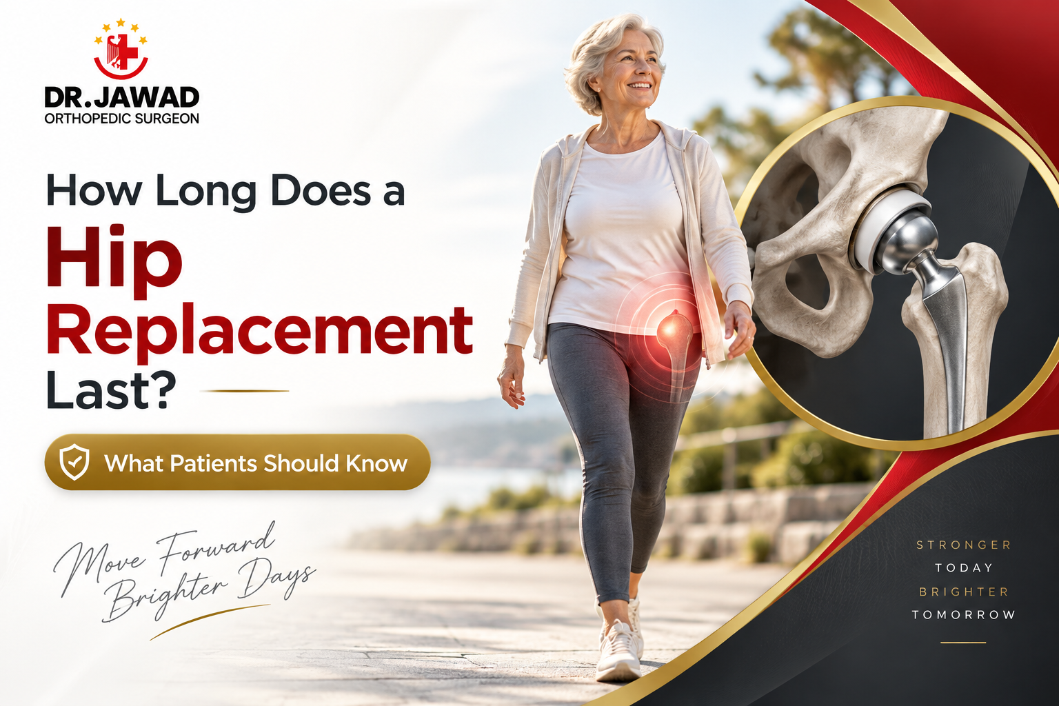 How Long Does a Hip Replacement Last