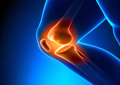 Arthroscopy Procedure