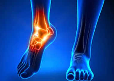 Sports Injuries