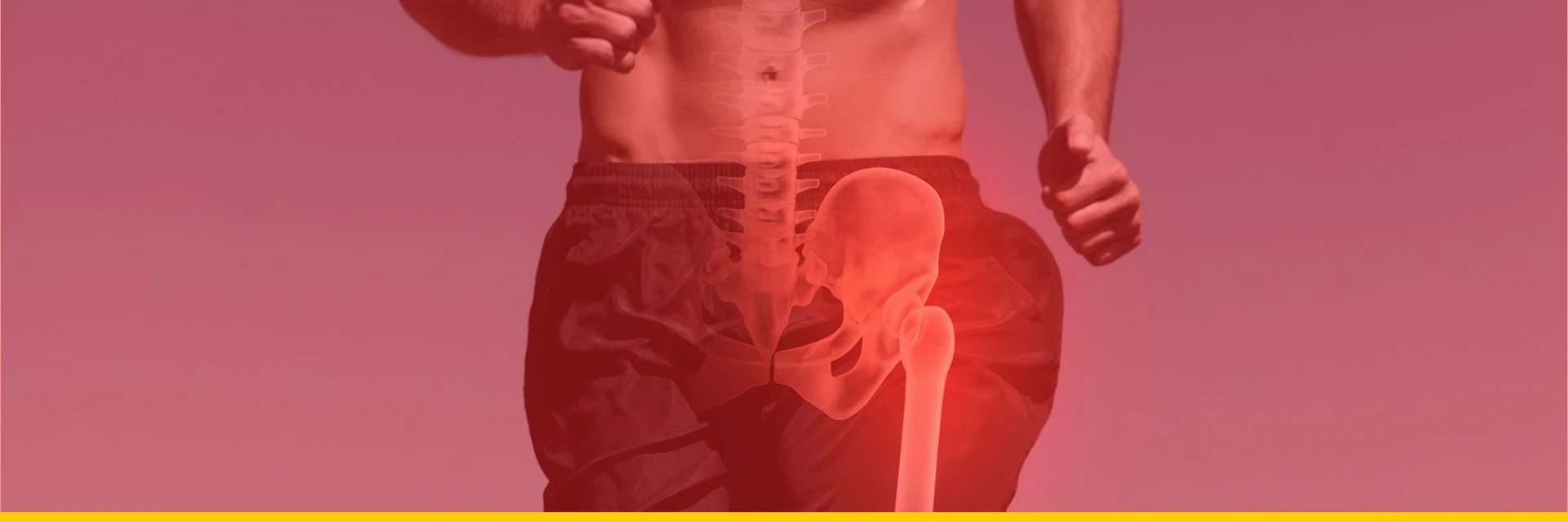 Hip Replacement