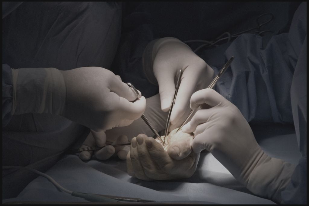 Hand & Microvascular Surgery
