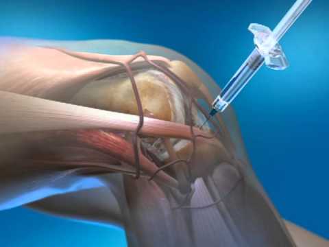 Treatment Options