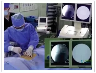 Spine Treatment 1