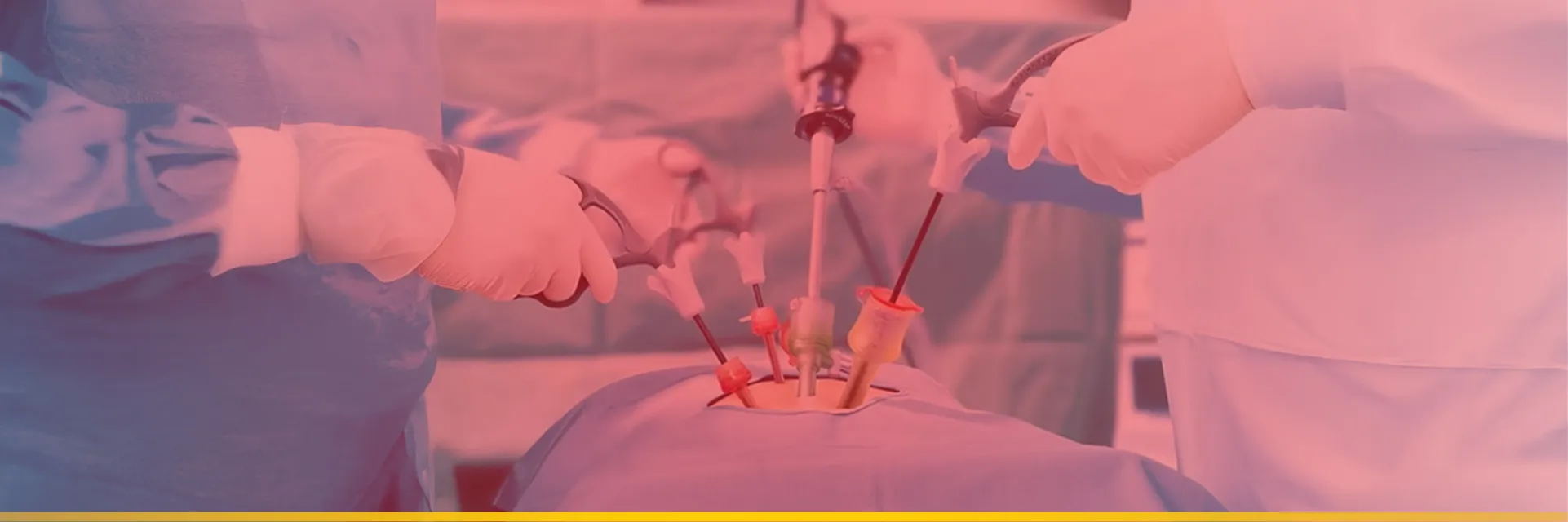 Laparoscopic Surgery